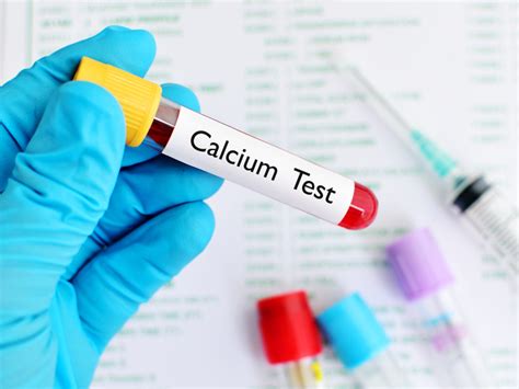 calcium blood test bottle colour|what is a calcium test.